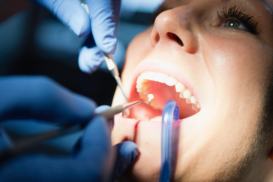 Cosmetic Fillings: A Natural & Durable Solution for Restoring Your Smile in Fort Collins, CO